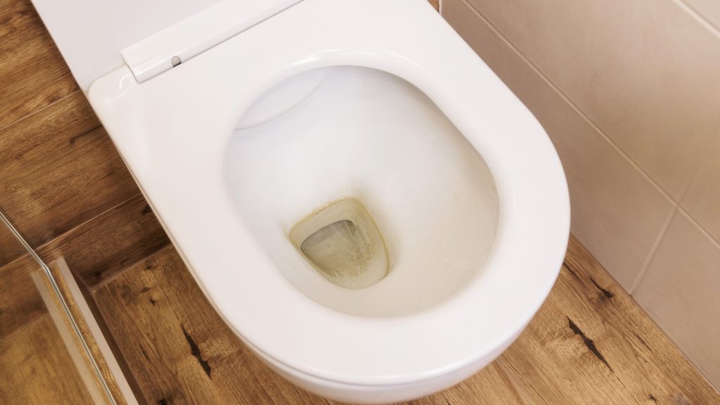 Toilet bowl with brown toilet stains and mineral buildup at the base.